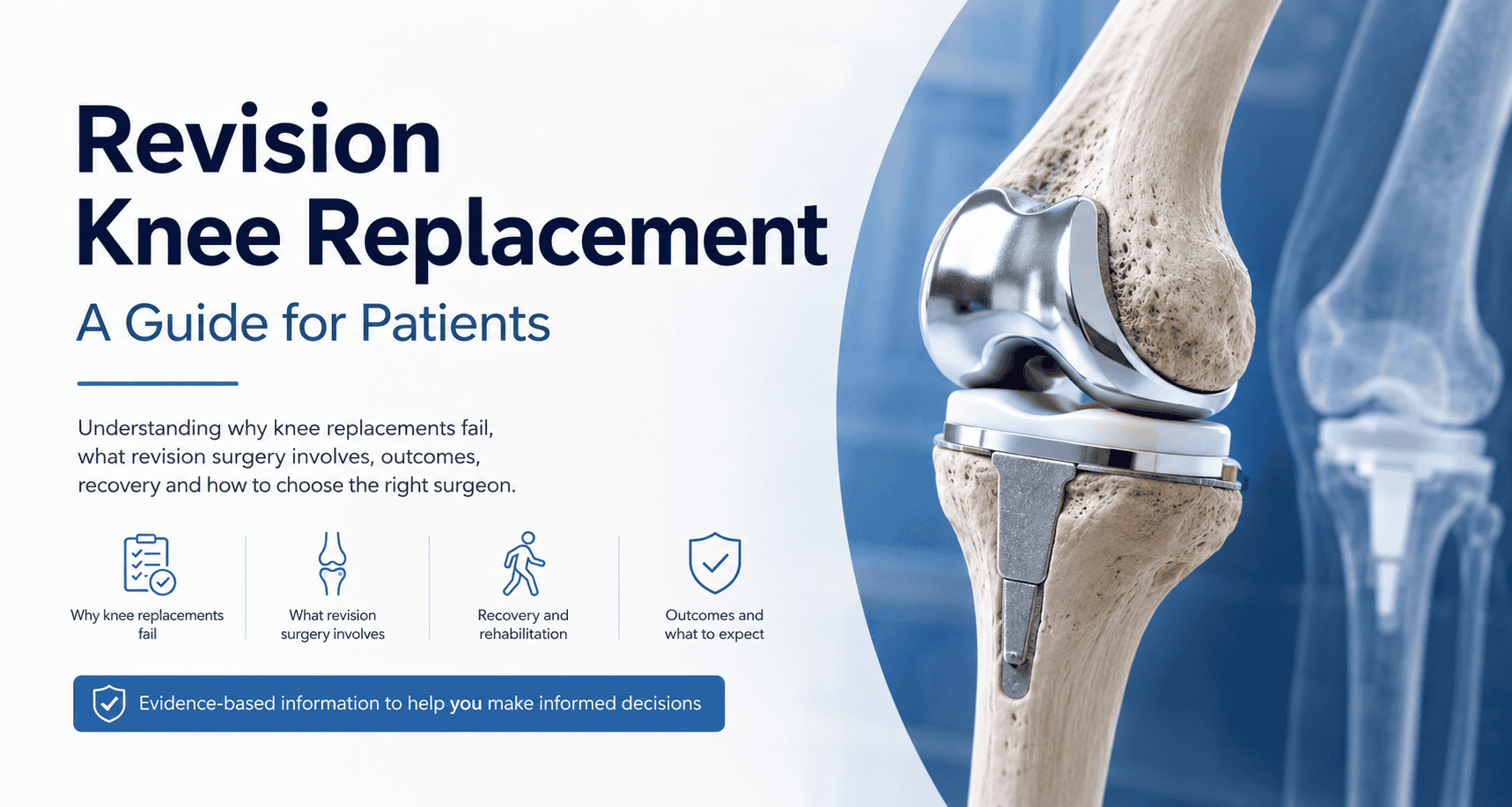 revision knee replacement