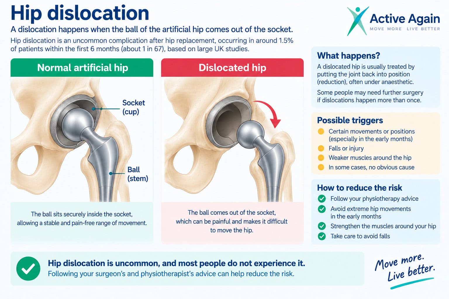 hip dislocation after surgery