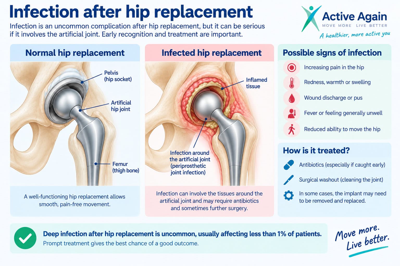 infection after hip replacment