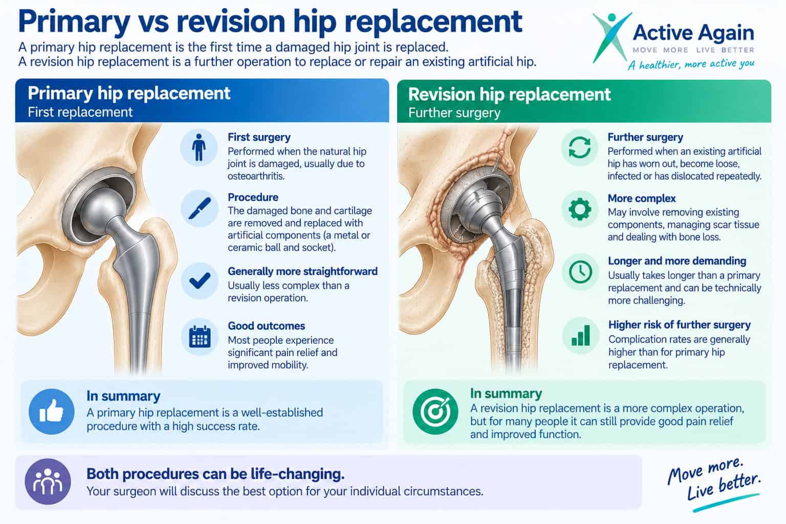 primary versus revision hip surgery